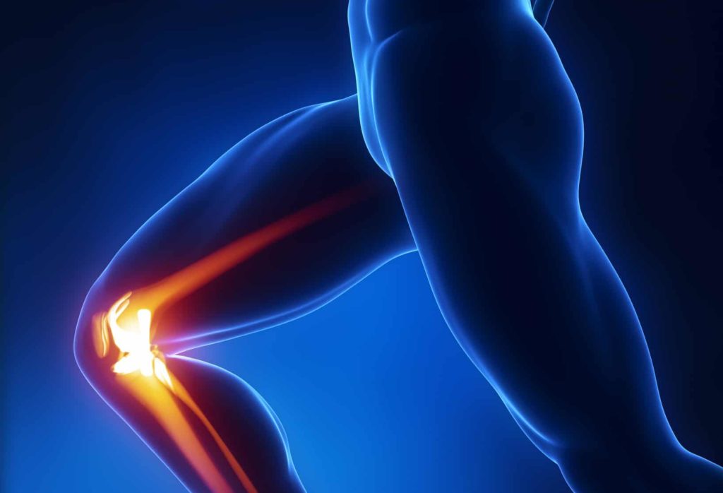 How Do I Know If My Knee Cap Is Tracking Correctly? 