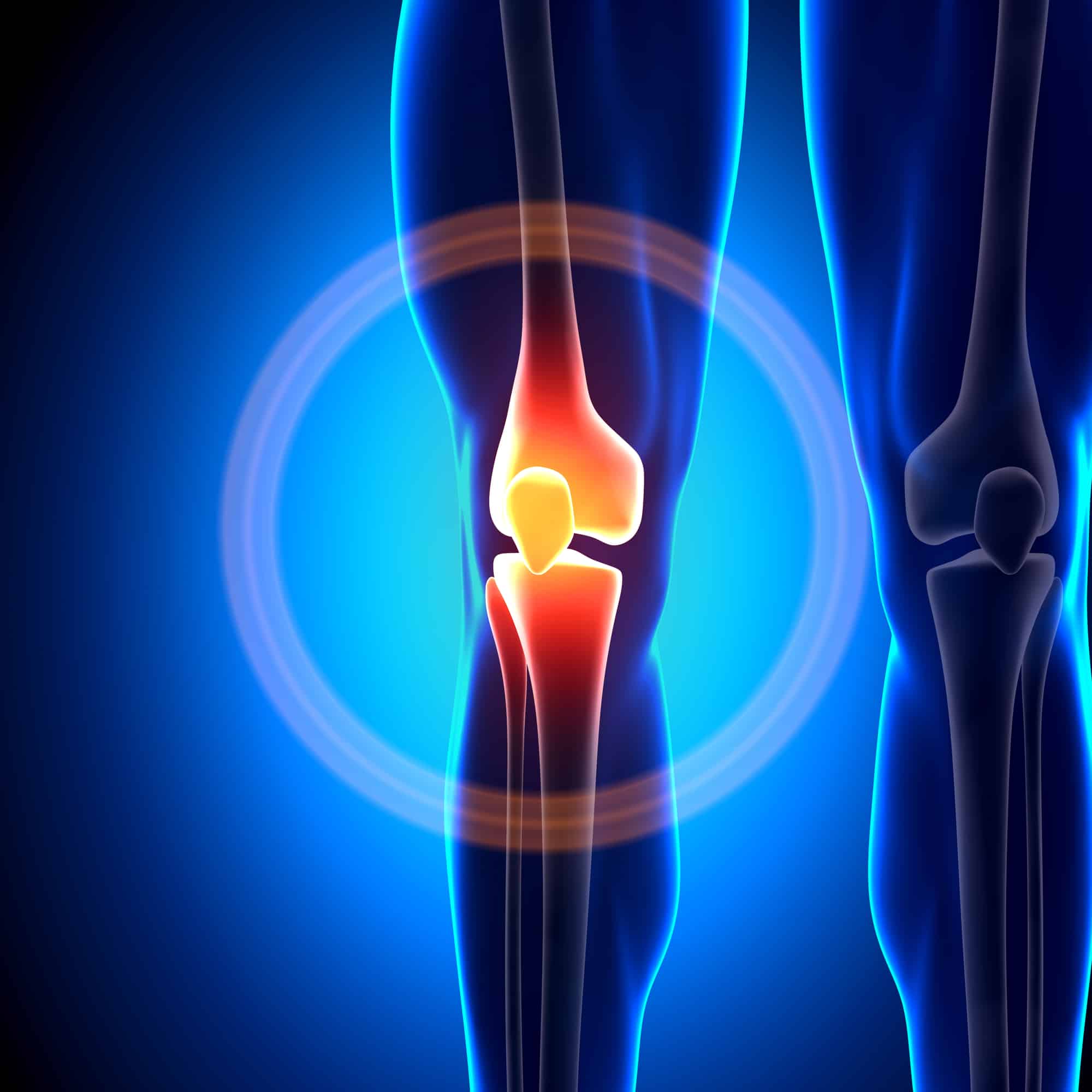 Should I Be Worried About My Clicking Knee? | PT For Everyone